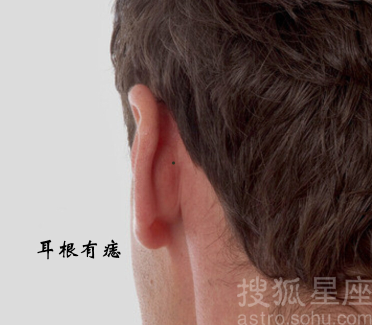 男人脸上的痣图解 男人脸上的痣图解大图 男人