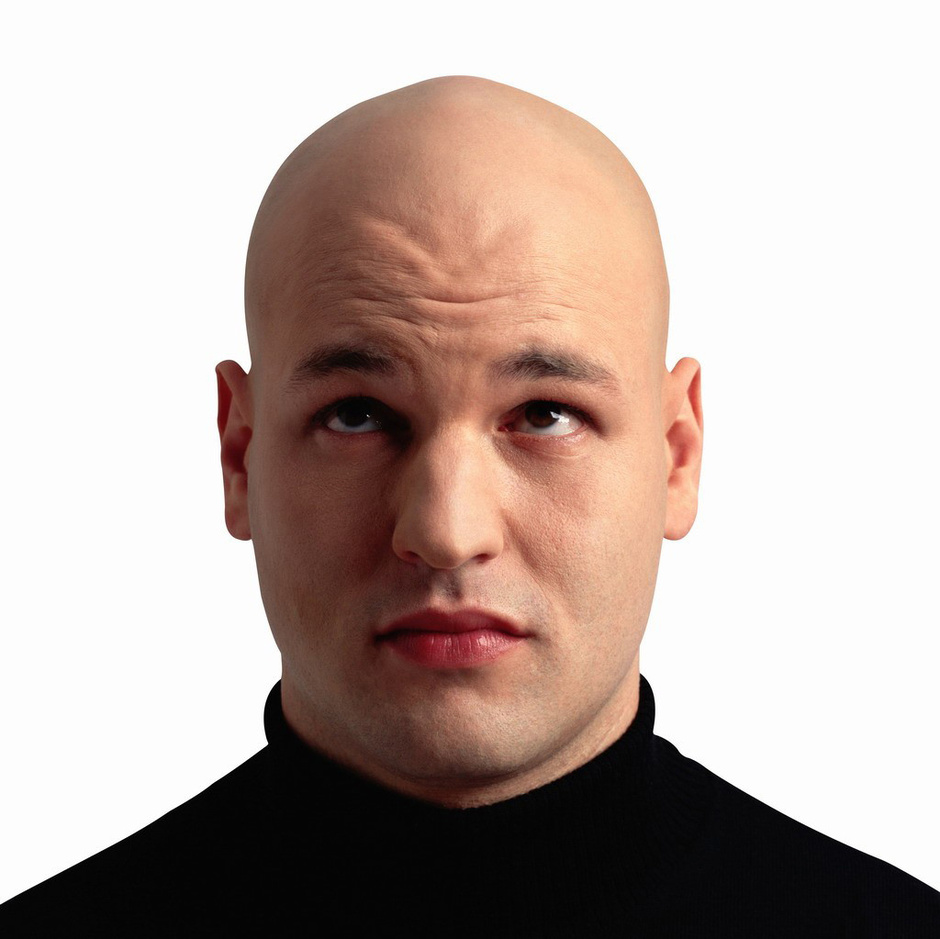 【转载】日本男人亚洲最秃秃顶男有人爱?