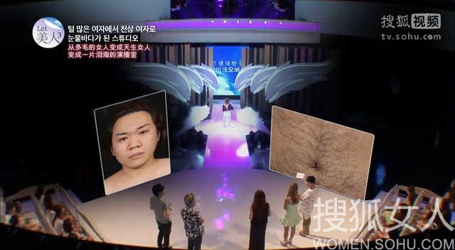 容貌改变命运 <em>多毛</em>女变性般整形5535018-<em>女人</em>