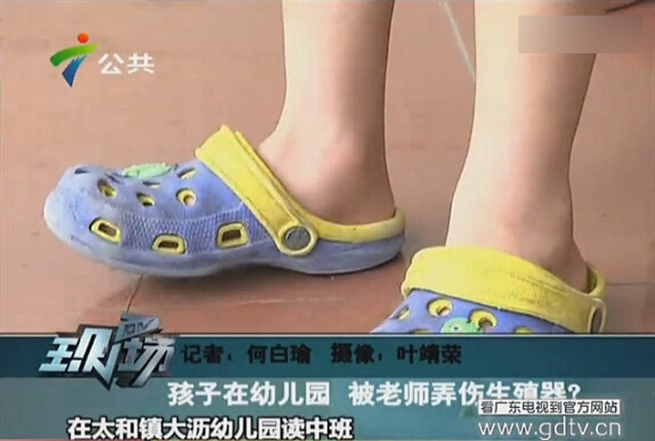 5岁男童被老师用打火机烧<em>生殖器</em>6859626-新闻