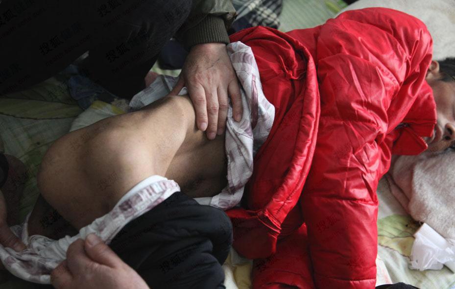 【新消息】  农民 工 艾滋 感染者躺地等死 - 婷的