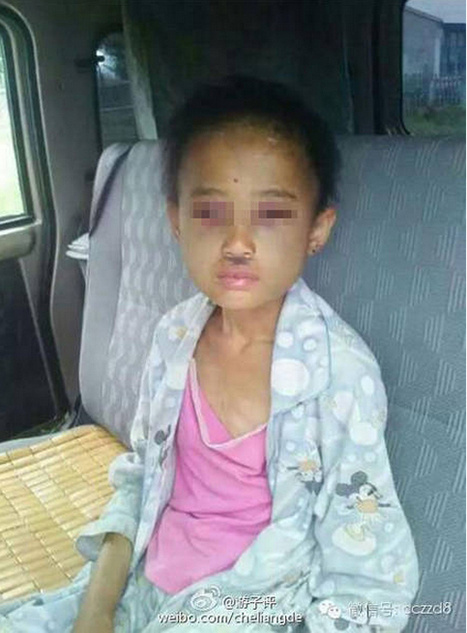 吉林11岁妹妹遭虐待 15岁姐姐遭性侵